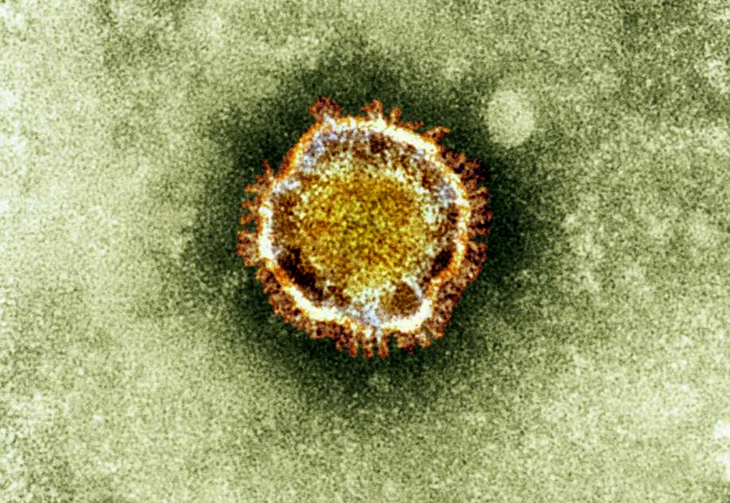 Trois cas du coronavirus semblables au SRAS avaient été suspectés en France. Un seul est confirmé.