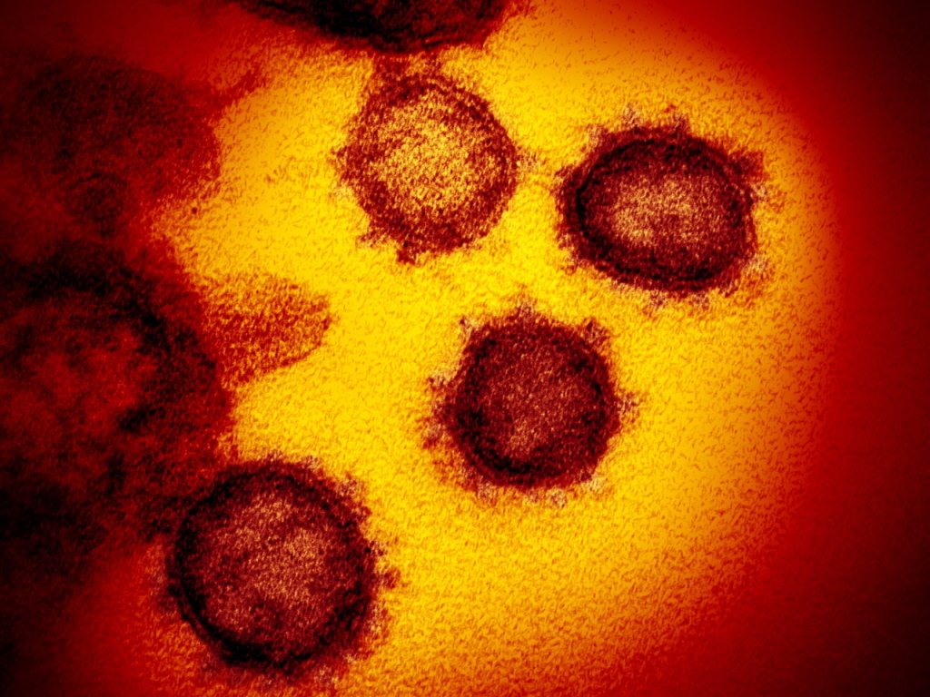 Le coronavirus tue trois fois plus que la grippe en hôpital (archives).