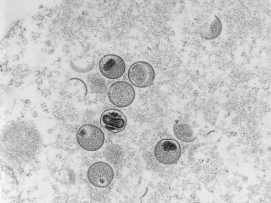 Un premier décès dû à la variole du singe a été confirmé en Espagne, soit le deuxième hors d'Afrique et le premier en Europe.
