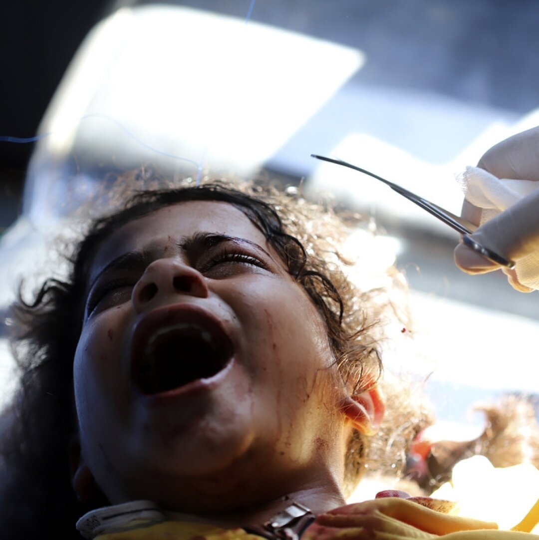 Des médecins palestiniens soignent une fillette blessée lors du bombardement israélien à l’hôpital du camp de réfugiés de Rafah, dans le sud de la bande de Gaza.