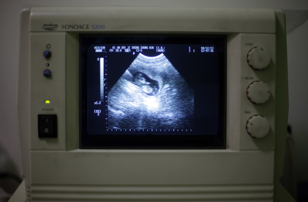 Des éléments cruciaux du dossier ont disparu, notamment le placenta et plusieurs échographies du bébé. (Illustration)