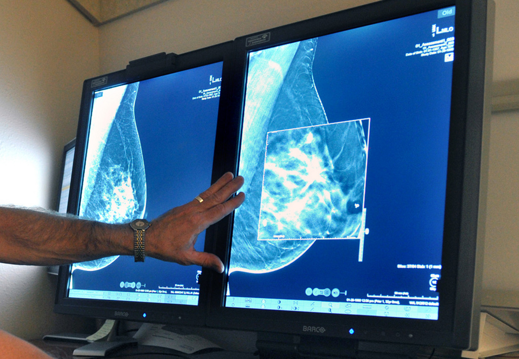 Selon la Fondation des Grangettes, l'accroissement du nombre de cancers du sein dans les pays industrialisés qui a été observé ces dernières décennies demeure largement inexpliqué.