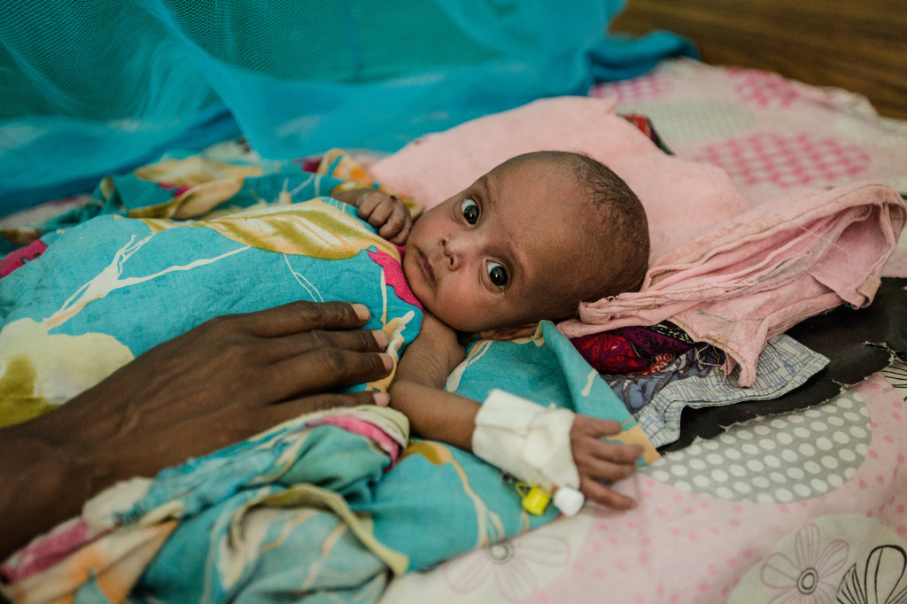 La malnutrition aiguë sévère est illustrée par "un enfant fragile et squelettique qui a besoin d'un traitement urgent pour survivre", selon l'Unicef.