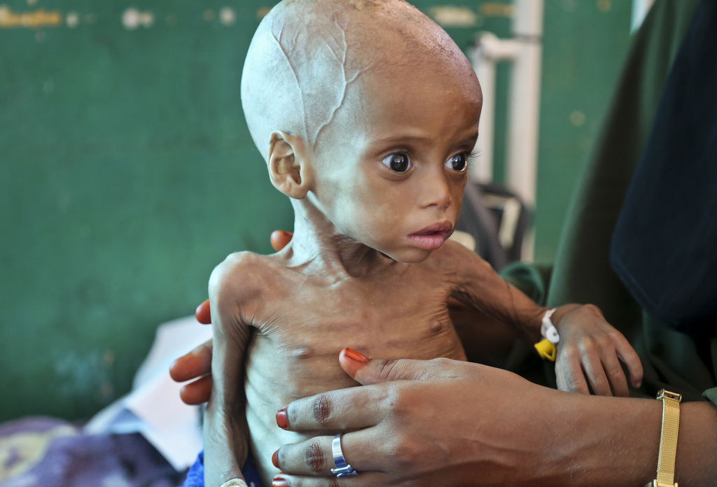 Selon l'ONU, la famine qui sévit en Somalie, au Yémen, au Soudan du Sud et au Nigeria menace de devenir la plus grande crise humanitaire depuis la Deuxième Guerre mondiale.