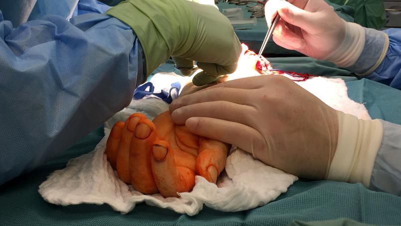 Les interventions de chirurgie de la main font partie de la liste des 16 opérations qui seront prioritairement réalisées en mode ambulatoire à partir de janvier prochain en Valais. 
