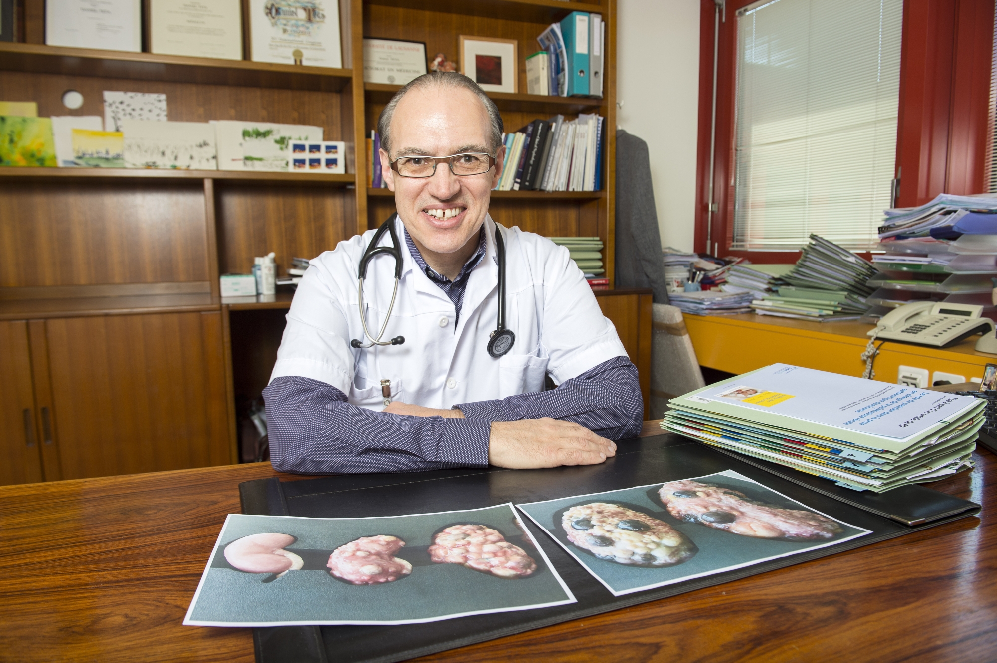 Daniel Teta, professeur et chef du Service de néphrologie à l'hôpital de Sion, présente l'évolution de la polykystose rénale.