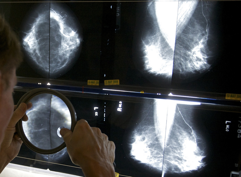 Près de 2000 cas de cancers sont diagnostiqués chaque année en Valais.