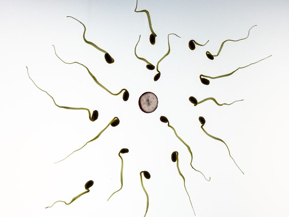 Non seulement la qualité du sperme des Suisses est faible, mais celle-ci semble être liée à une augmentation du cancer des testicules.