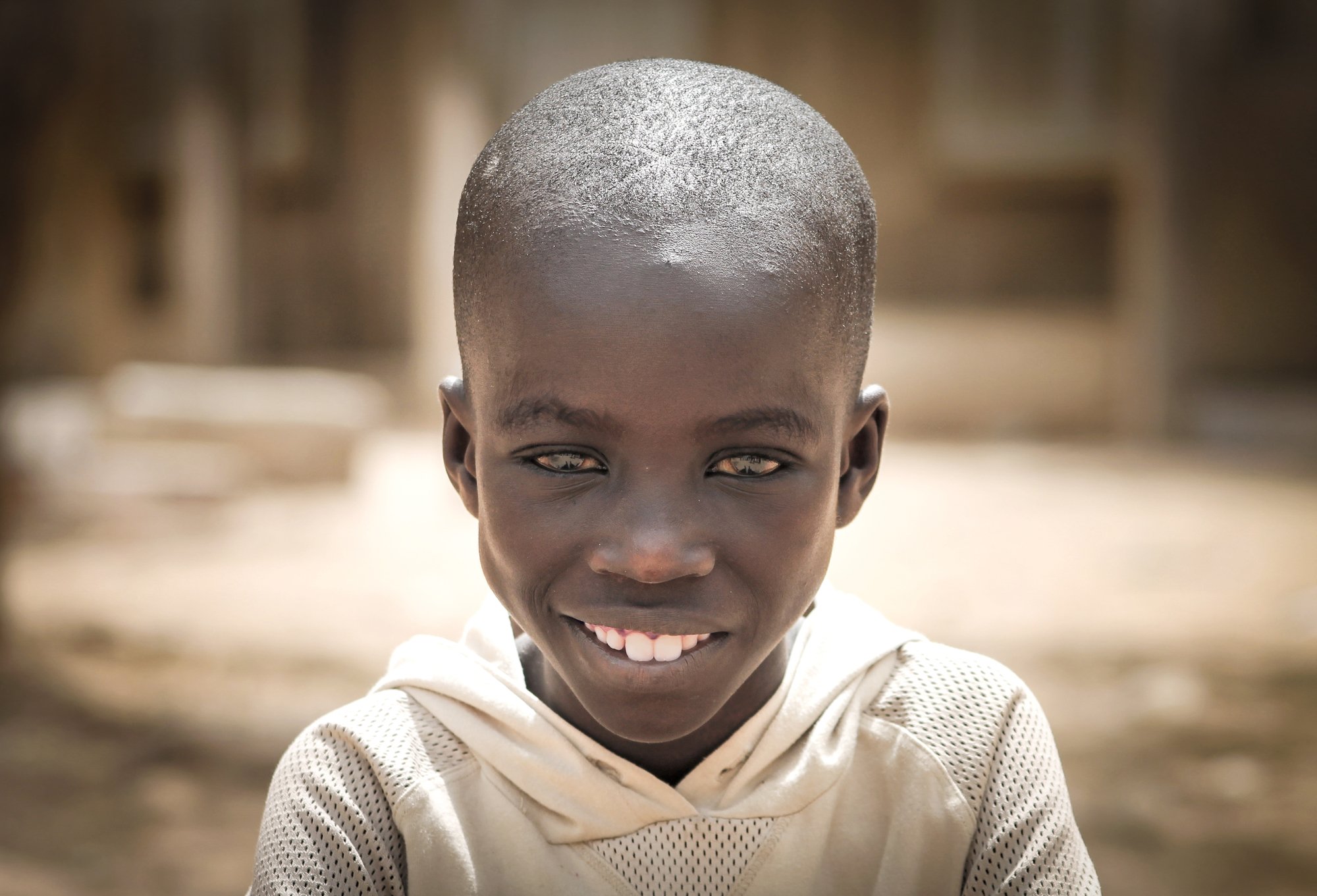 Il y a un an, nous vous racontions l'histoire d'Adboulaye, ce petit garçon sénégalais sauvé par Terre des hommes.