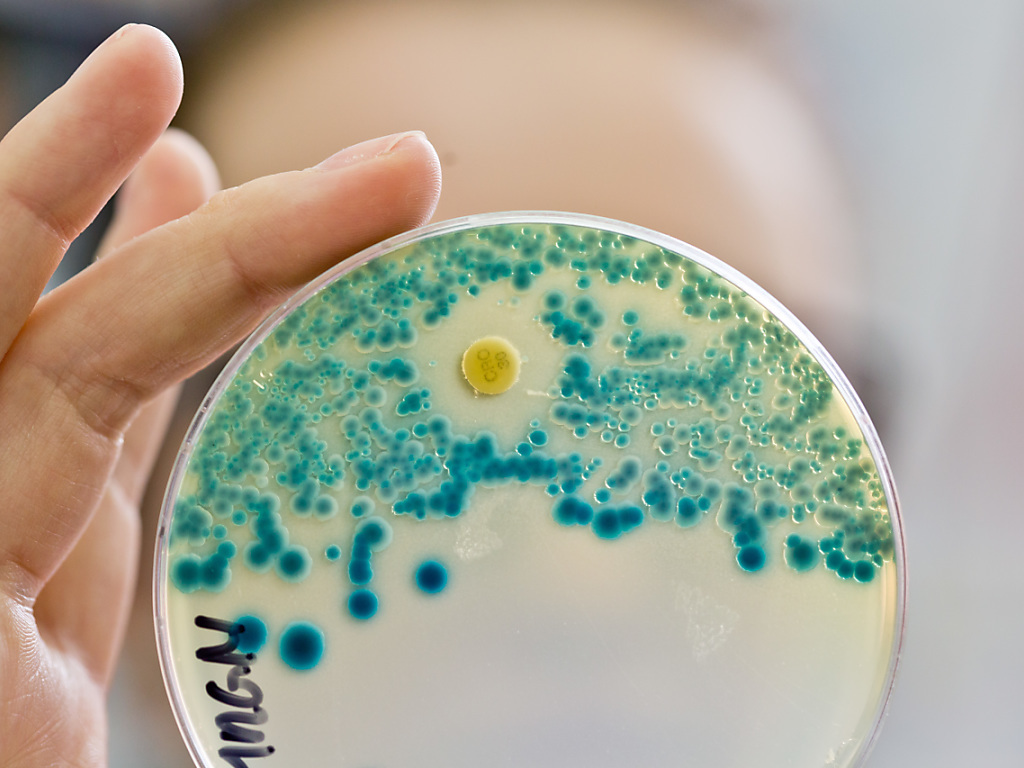 Les bactéries peuvent devenir résistantes quand les patients utilisent des antibiotiques dont ils n'ont pas besoin. (Illustration)